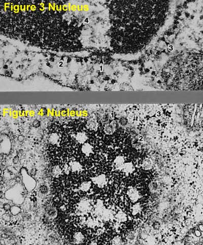 electron-micrographs